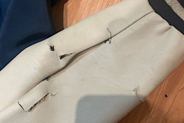 В Редкино собака охотничьей породы напала на ребёнка