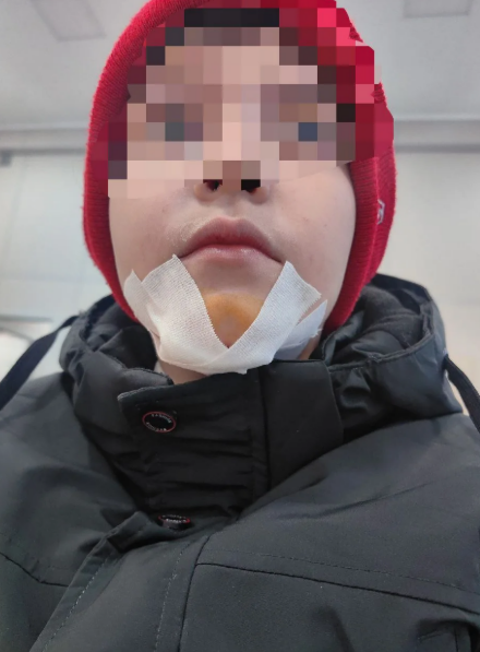 После избиения школьника в Тверской области возбудили уголовное дело После избиения школьника в Тверской области возбудили уголовное дело